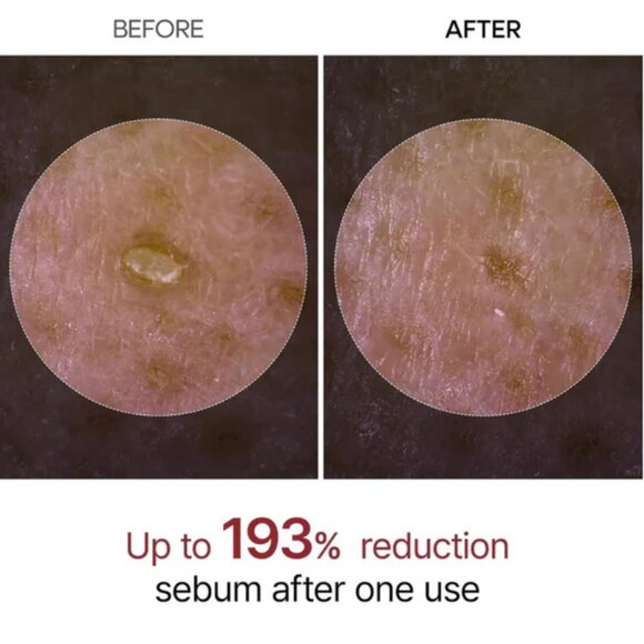 Dr. Melaxin Black Rice Peel Shot + Facial Scrubber - Picture 4 of 7